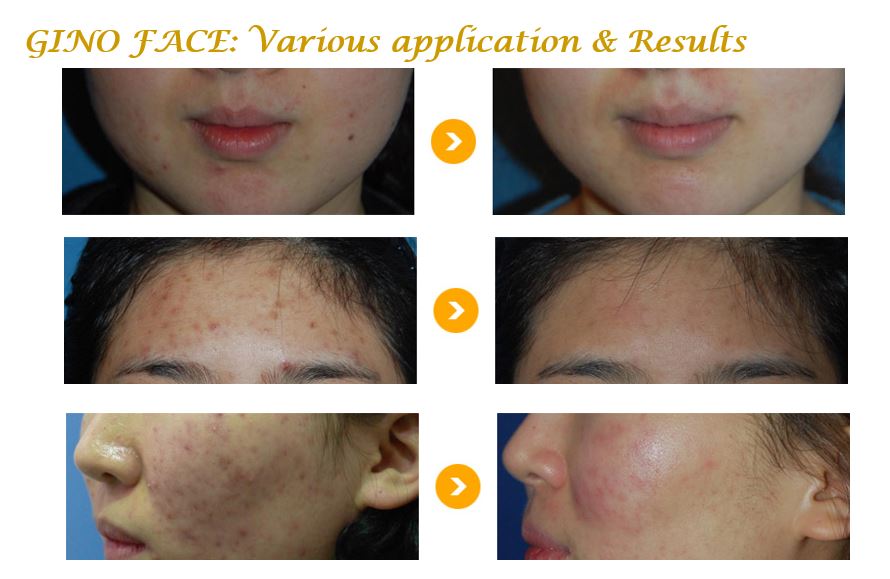 gino facial products